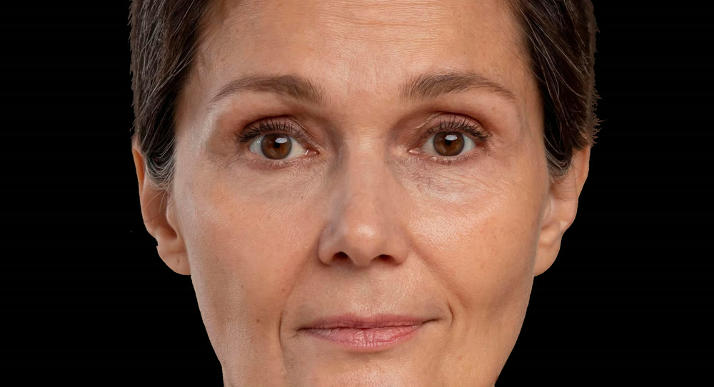 Peau avant HydraFacial